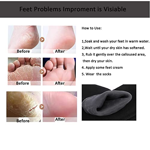 For Men - Heal Your feet while you Sleep - Moisturizing Gel Socks