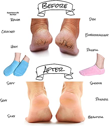 Heal Your feet while you Sleep - Moisturizing Gel Socks